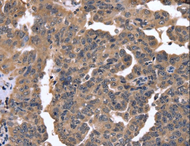 FGFR1OP2 Antibody