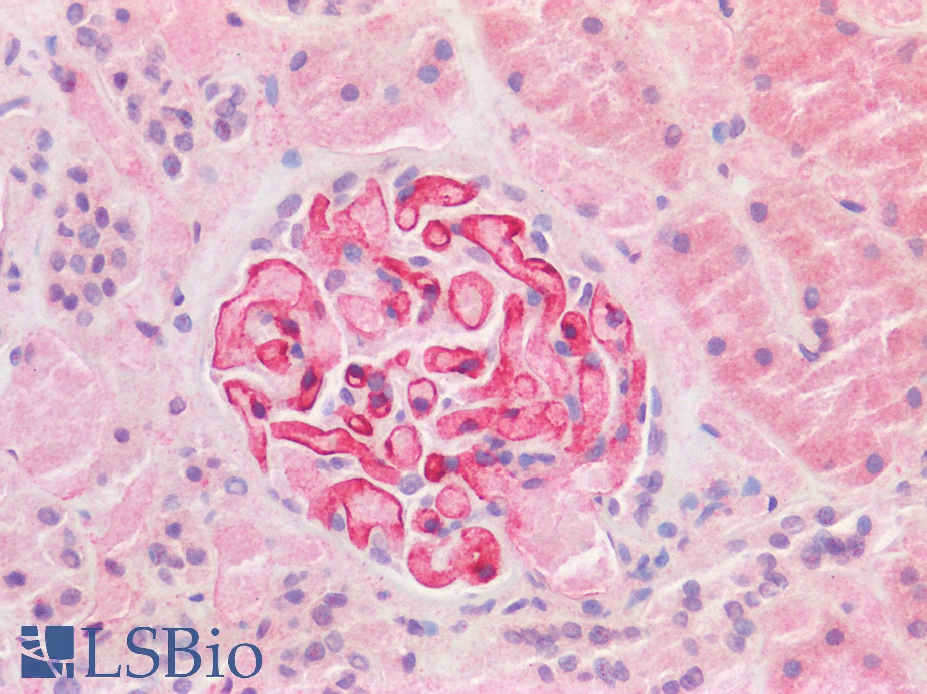 IHC-plus™ TMPRSS2 / Epitheliasin Antibody