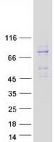 Human RANBP10 Protein (Recombinant Myc-DDK (Flag))