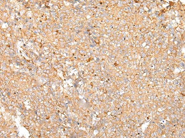 PRDX4 / Peroxiredoxin 4 Antibody