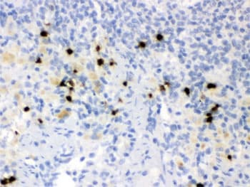 LCN2 / Lipocalin 2 / NGAL Antibody