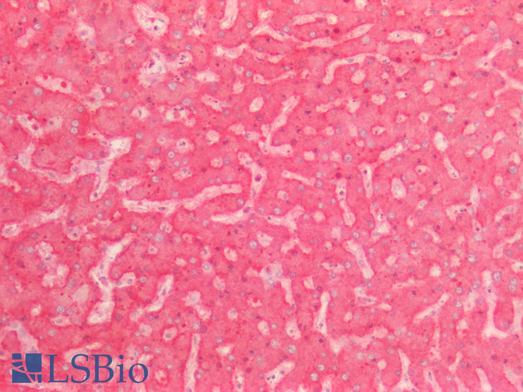 PathPlus™ KNG1 / Kininogen / Bradykinin Antibody (aa1-416)