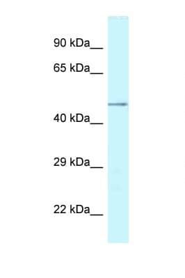 Polyclonal Rabbit anti-Human YKL39 / CHI3L2 Antibody (aa36-85, WB)