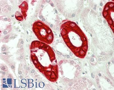 IHC-plus™ KRT19 / CK19 / Cytokeratin 19 Antibody (Internal)