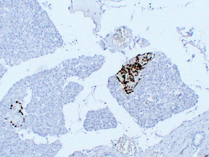 GCG / Glucagon Antibody (clone ABT-GCG)