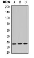 Polyclonal Rabbit anti-Human PP2Ac / PPP2CA Antibody (C-Terminus, IHC, IF, WB)