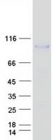 Human MASP1 / MASP Protein (Recombinant Myc-DDK (Flag))