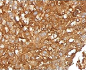 B2M / Beta 2 Microglobulin Antibody (clone MGBP2-1)