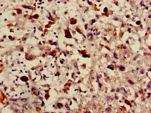 Polyclonal Rabbit anti-Human ABCA2 Antibody (IHC)