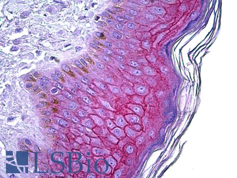 IHC-plus™ DSG1 / Desmoglein 1 Antibody (aa841-855)