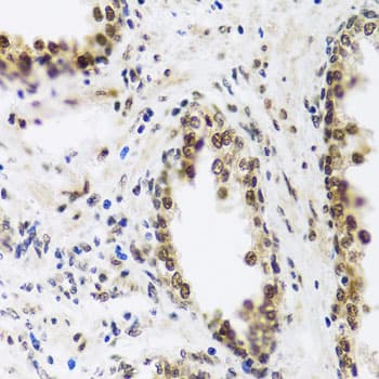 SAFB2 Antibody