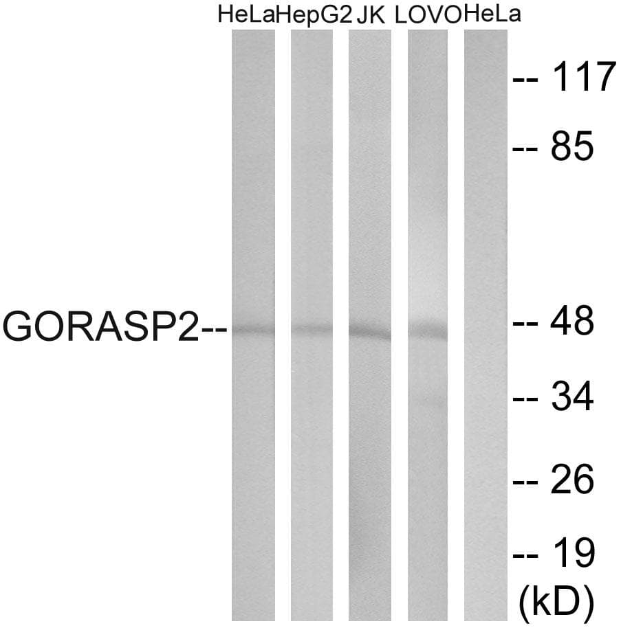 Polyclonal Rabbit anti-Human GORASP2 / GRASP55 Antibody (WB)