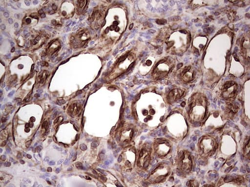 Peripherin Antibody (clone OTI1E10, Carrier-free)