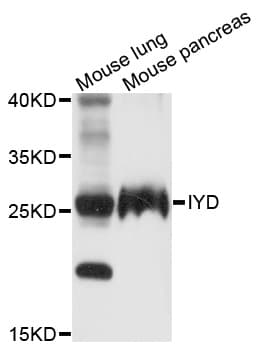 Polyclonal Rabbit anti-Human IYD Antibody (WB)
