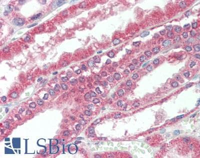 IHC-plus™ PKD1 / Polycystin Antibody (aa3725-3735)