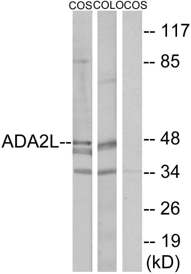 Polyclonal Rabbit anti-Human TADA2L / ADA2A Antibody (aa206-255, WB)