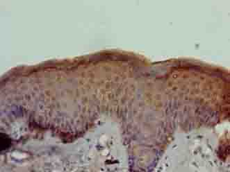 STOX1 Antibody
