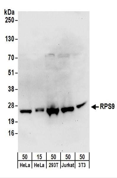Polyclonal Rabbit anti-Human RPS9 / Ribosomal Protein S9 Antibody (aa1-50, IHC, WB)