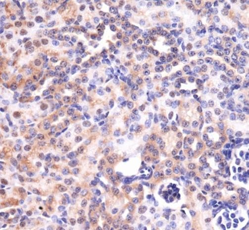 MAS1 / MAS Antibody