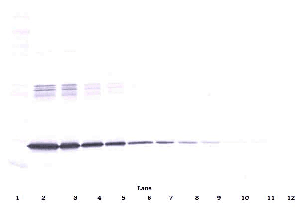 IL6 / Interleukin 6 Antibody