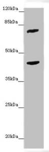 Polyclonal Rabbit anti-Human ACSL6 Antibody (IHC, WB)
