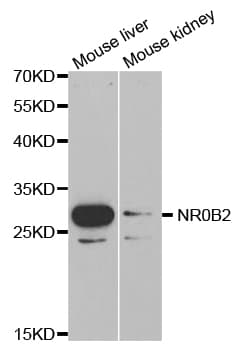 Polyclonal Rabbit anti-Human NR0B2 Antibody (IHC, IF, WB)