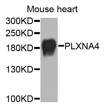 Polyclonal Rabbit anti-Human PLXNA4 / Plexin A4 Antibody (WB)