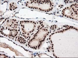 NUDT18 Antibody (clone OTI5D7)