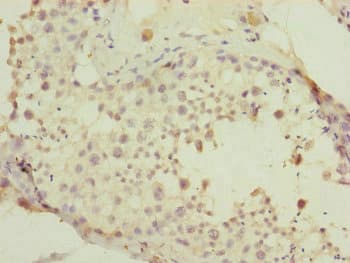 Polyclonal Rabbit anti-Human PDHA2 / PDH E1 Beta Antibody (IHC, WB)