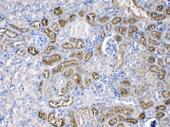AGT / Angiotensinogen Antibody