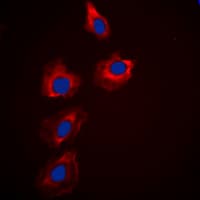 PAK1 + PAK2 + PAK3 Antibody (C-Terminus)