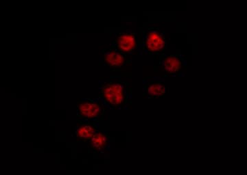 AML1 / RUNX1 Antibody