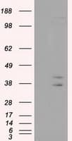 CAPZA1 / CAPZ Alpha 1 Antibody (clone OTI2G4)
