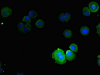 Polyclonal Rabbit anti-Human NOX5 Antibody (IHC, IF)