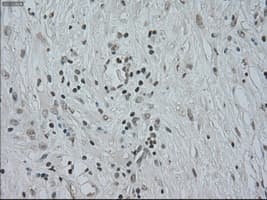 CTAG1B / NY-ESO-1 Antibody (clone OTI2B6)