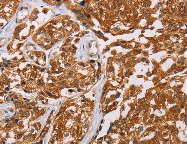 CRYAB / Alpha B Crystallin Antibody