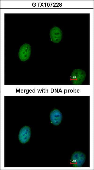 Polyclonal Rabbit anti-Human BEND5 Antibody (aa1-255, WB)