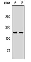 PathPlus™ NES / Nestin Antibody