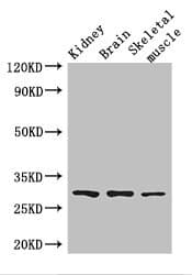 PLD6 / Phospholipase D6 Antibody