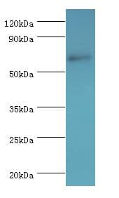 MSLN / Mesothelin Antibody (aa37-296)