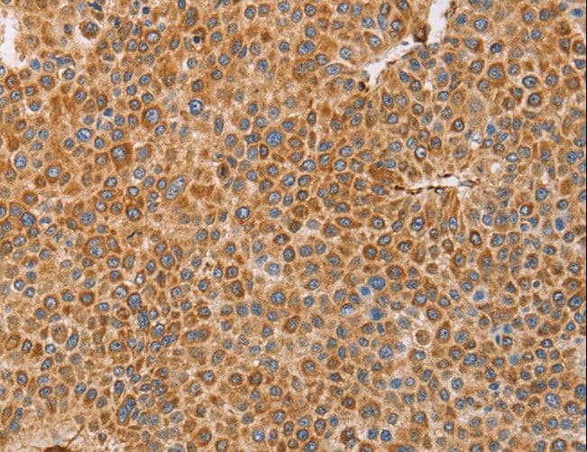 Polyclonal Rabbit anti-Human BRS3 Antibody (IHC)