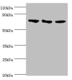 NCL / Nucleolin Antibody (aa411-710)