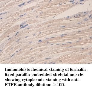 ETFB Antibody (Internal)