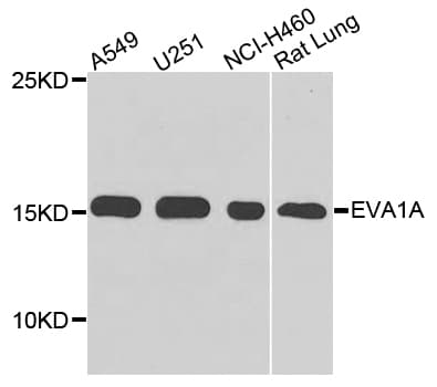 Polyclonal Rabbit anti-Human FAM176A / TMEM166 Antibody (IHC, WB)