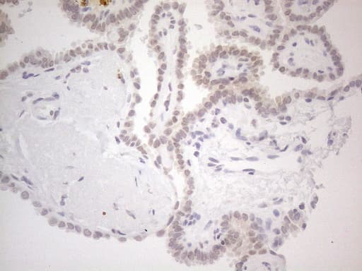 IRS1 Antibody (aa1-280, clone OTI2B10)