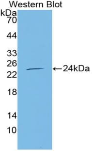 NOS3 / eNOS Antibody
