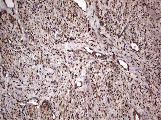 MTDH / Metadherin Antibody (aa70-582, clone OTI2F11)