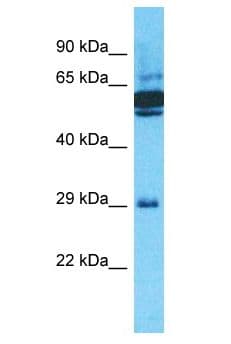 OR10J5 Antibody (aa188-237)