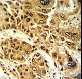 LPIN2 / Lipin 2 Antibody (aa262-288)