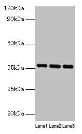 APOE / Apolipoprotein E Antibody